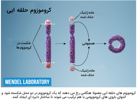 کروموزوم حلقوی