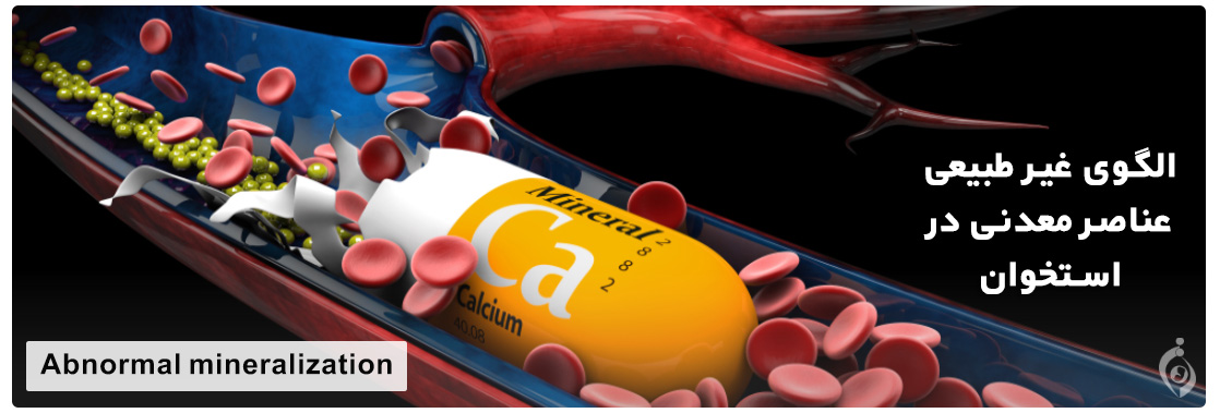 Abnormal mineralization