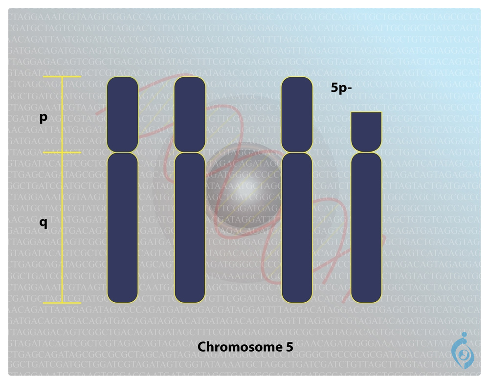 Мужская хромосома 5. 5 Хромосома. Пятая хромосома. Пятая хромосома человека. P В хромосомах.
