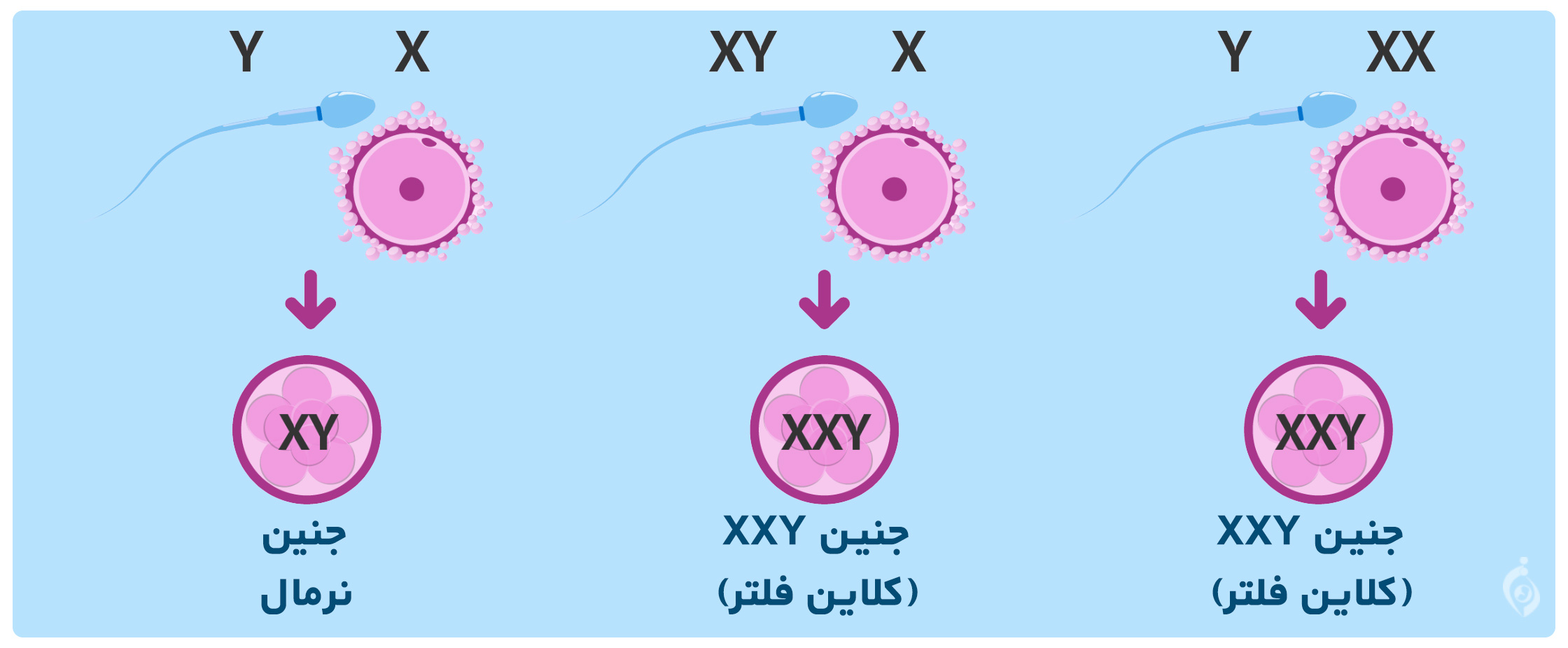 جنین کلاین فلتر