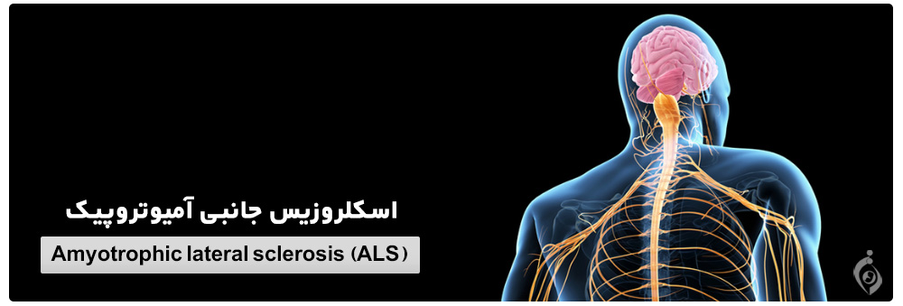 اسکلروزیس جانبی آمیوتروپیک (ALS)
