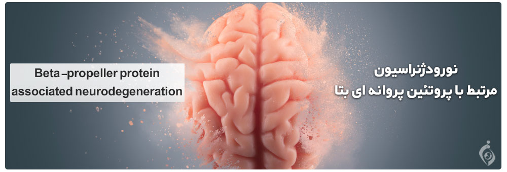 Beta-propeller protein-associated neurodegeneration