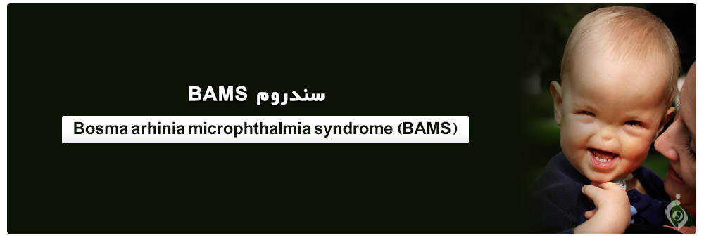 Bosma arhinia microphthalmia syndrome (BAMS)