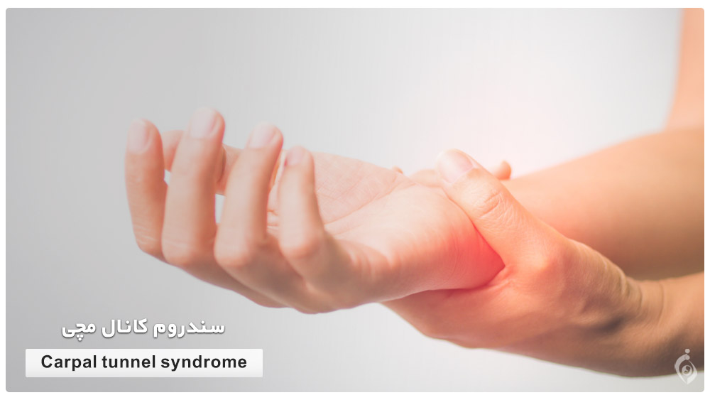 Carpal tunnel syndrome