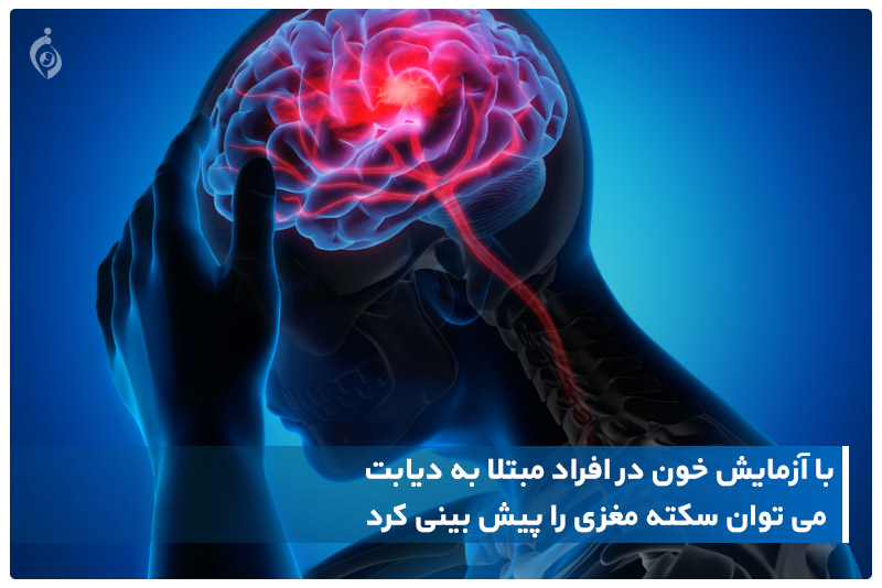 با آزمایش خون در افراد مبتلا به دیابت می توان سکته مغزی را پیش بینی کرد