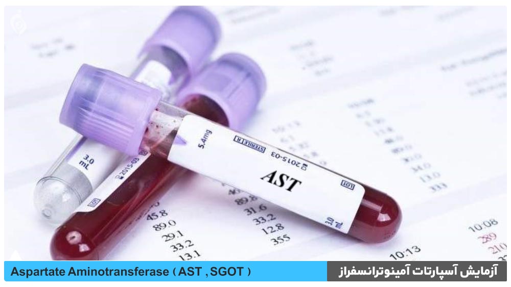 آزمایش آسپارتات آمینوترانسفراز