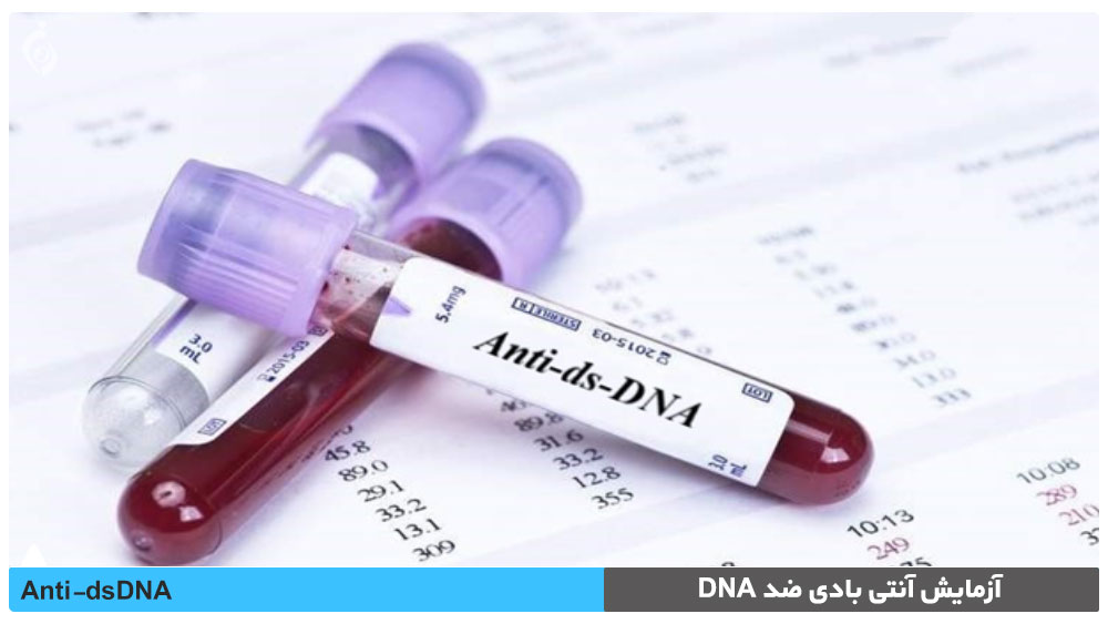 آزمایش آنتی بادی ضد DNA 