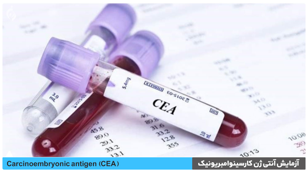 آزمایش آنتی ژن کارسینوامبریونیک (CEA)