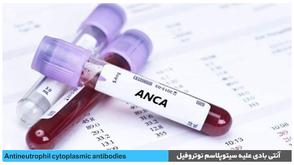 تست آنتی بادی علیه سیتوپلاسم نوتروفیل (ANCA)