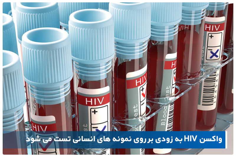 واکسن HIV به زودی بر روی نمونه های انسانی تست می شود