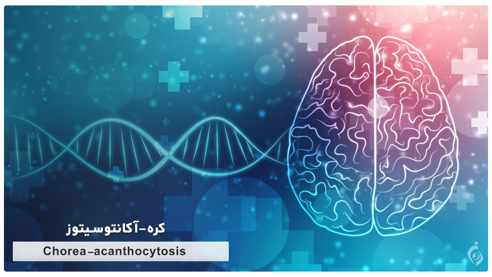 کره-آکانتوسیتوز (Chorea-acanthocytosis)