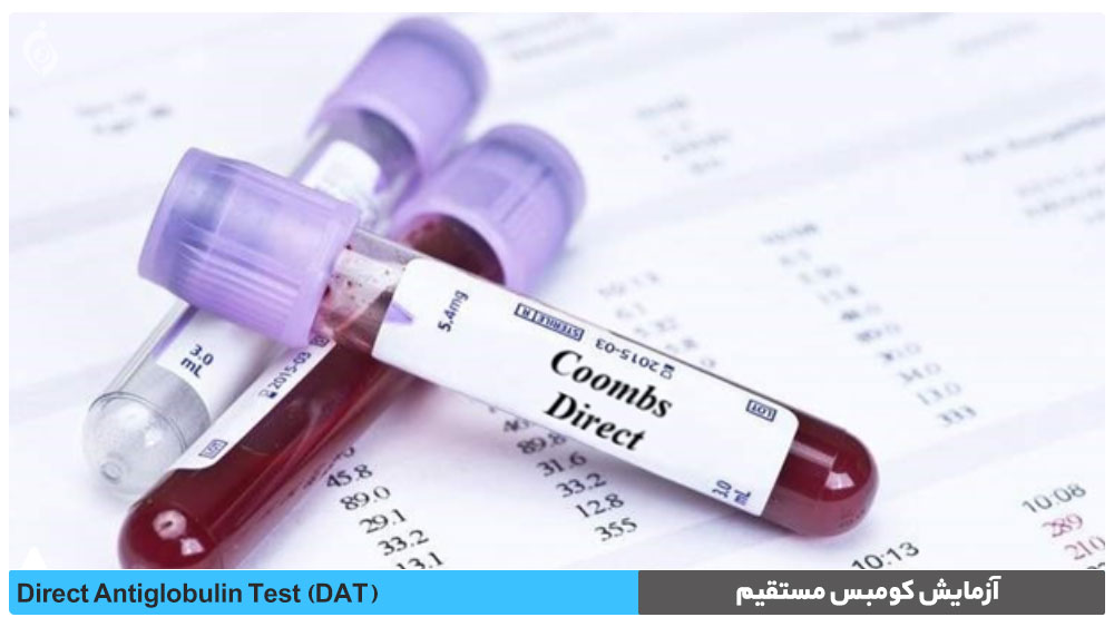 آزمایش کومبس مستقیم (آزمایش آنتی گلوبولین مستقیم)