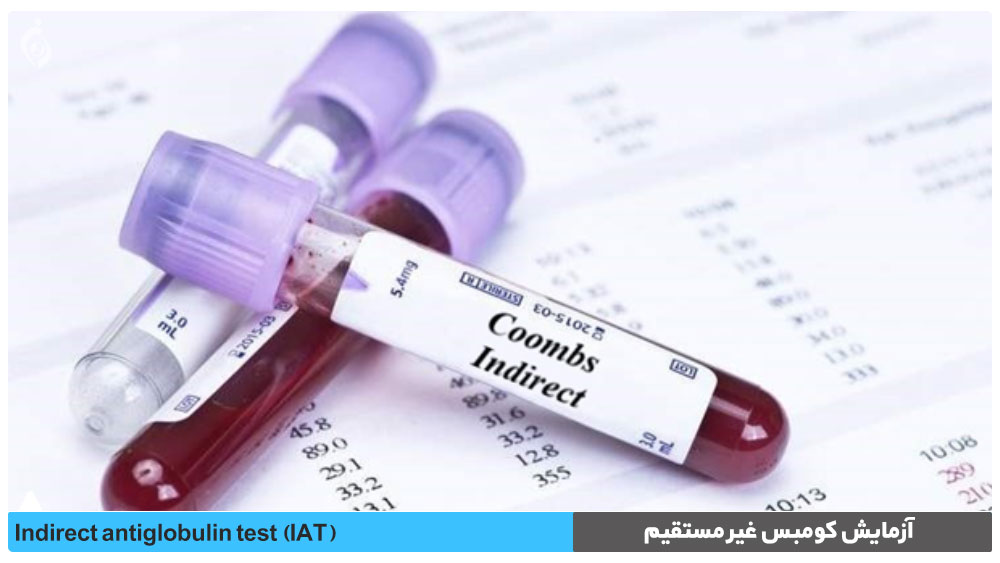 آزمایش کومبس غیر مستقیم