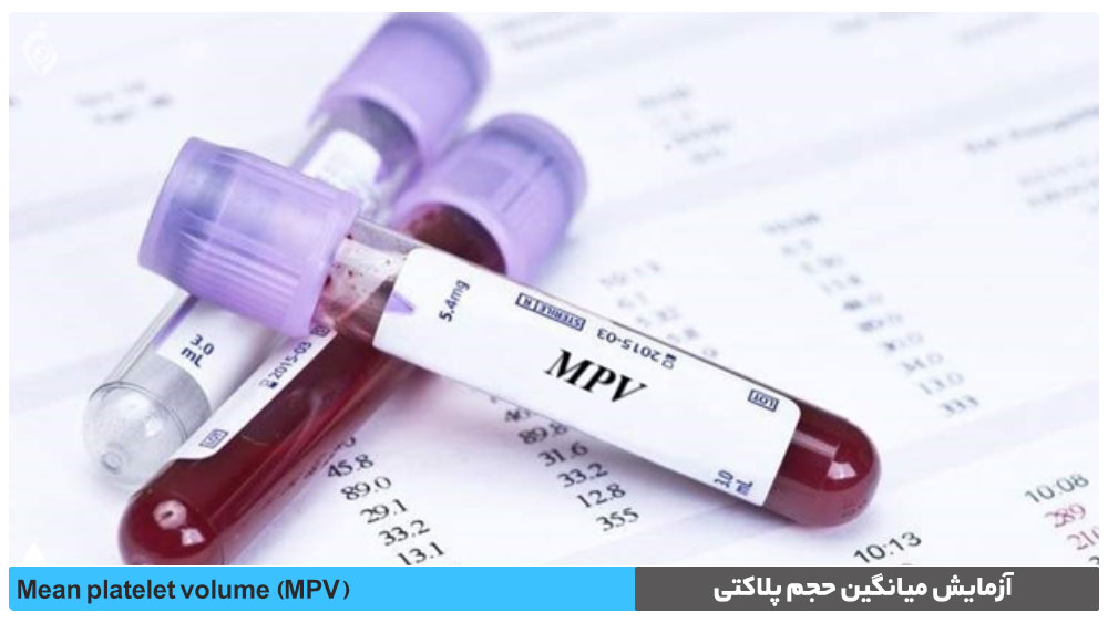 آزمایش میانگین حجم پلاکتی MPV