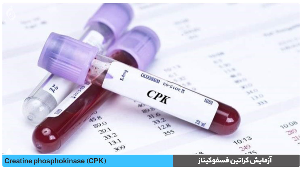 آزمایش کراتین فسفوکیناز (CPK)