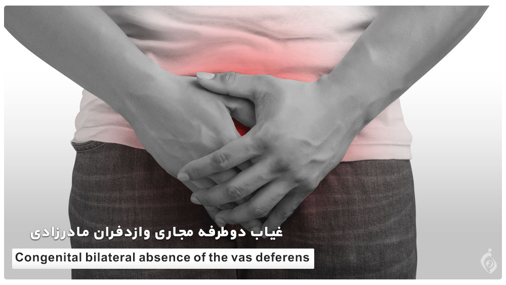 Congenital bilateral absence of the vas deferens