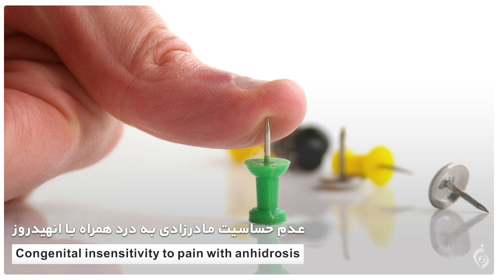 Congenital insensitivity to pain with anhidrosis