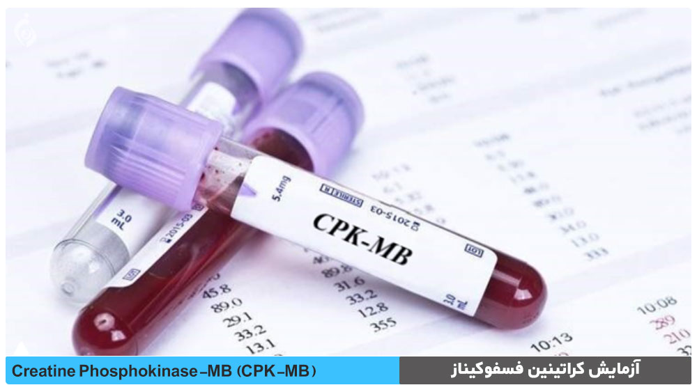 آزمایش کراتینین فسفوکیناز (CPK-MB)