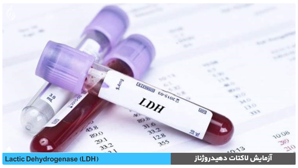 آزمایش لاكتات دهيدروژناز (LDH)