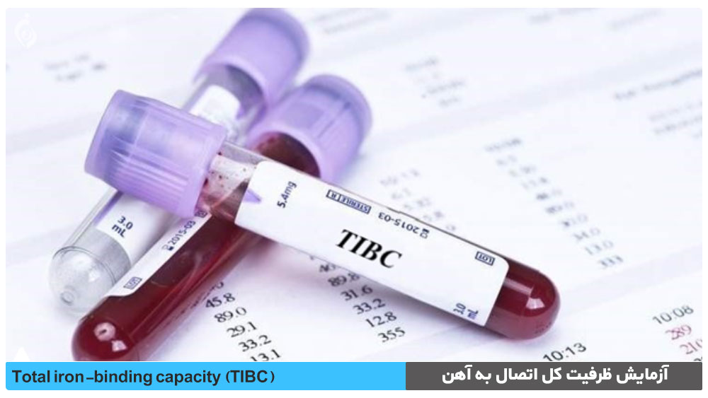 آزمایش ظرفیت کل اتصال به آهن (TIBC)