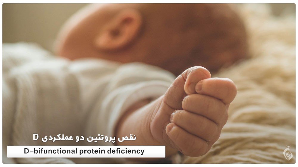 D-bifunctional protein deficiency