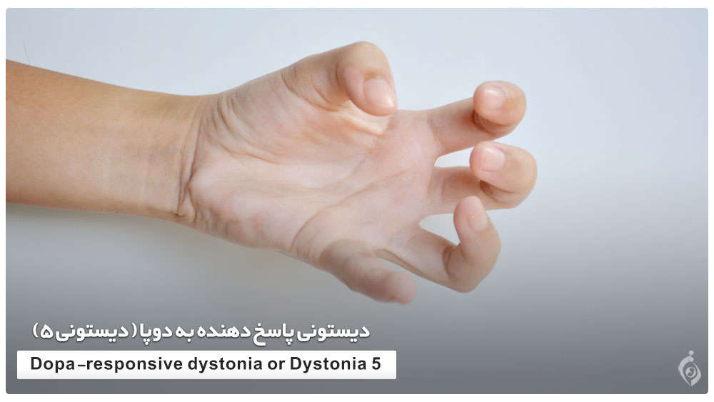 Dystonia