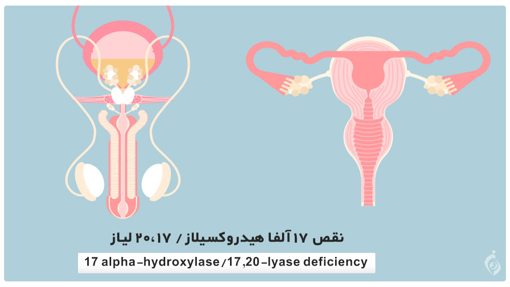 17 alpha-hydroxylase/17,20-lyase deficiency