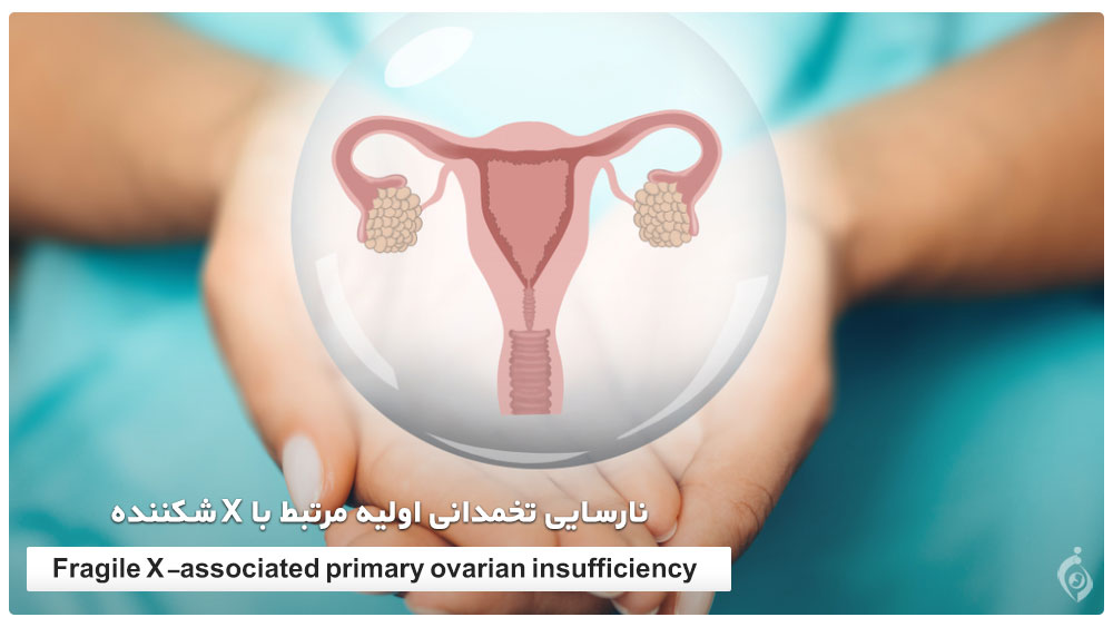 Fragile X-associated primary ovarian insufficiency