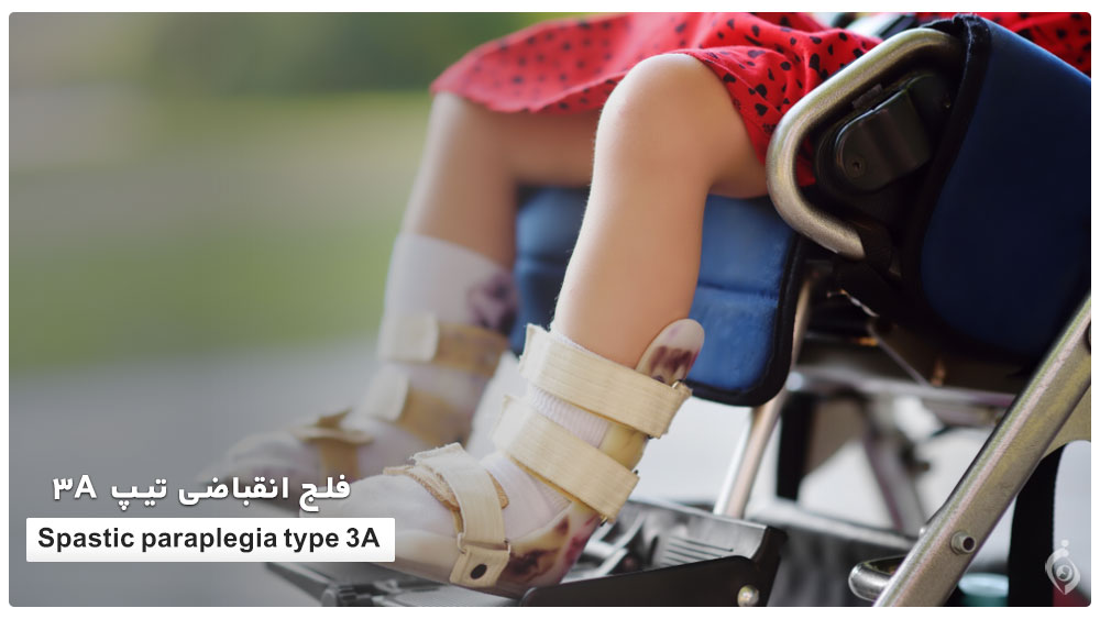 Spastic paraplegia type 3A