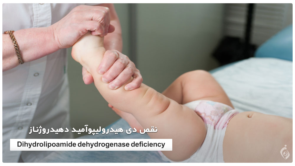 Dihydrolipoamide dehydrogenase deficiency