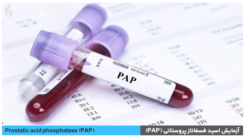 آزمایش اسید فسفاتاز پروستاتی (PAP)