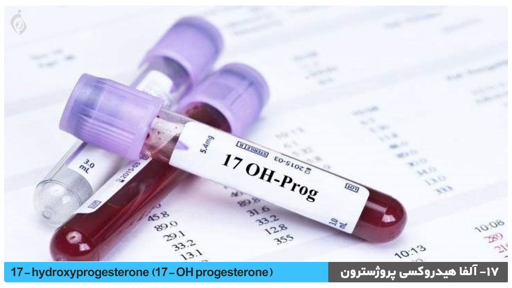آزمایش 17- آلفا هیدروکسی پروژسترون