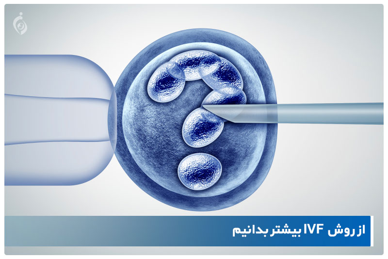 روش IVF