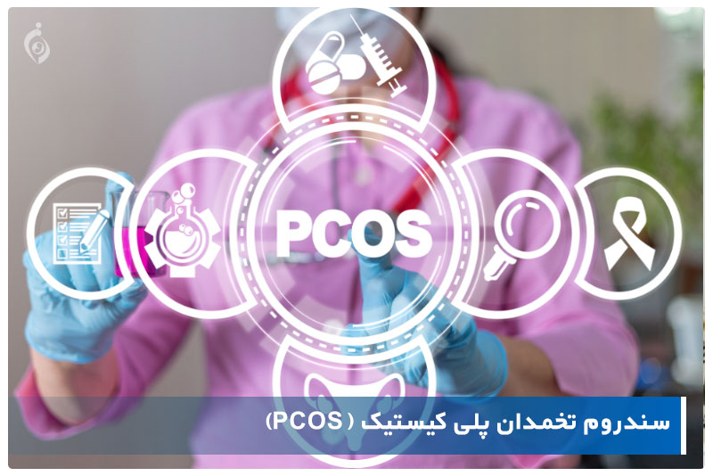 سندرم تخمدان پلی کیستیک (PCOS)