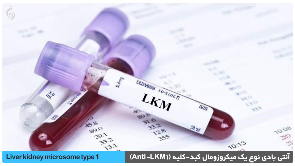 آنتی بادی نوع یک میکروزومال کبد-کلیه (Anti-LKM1)