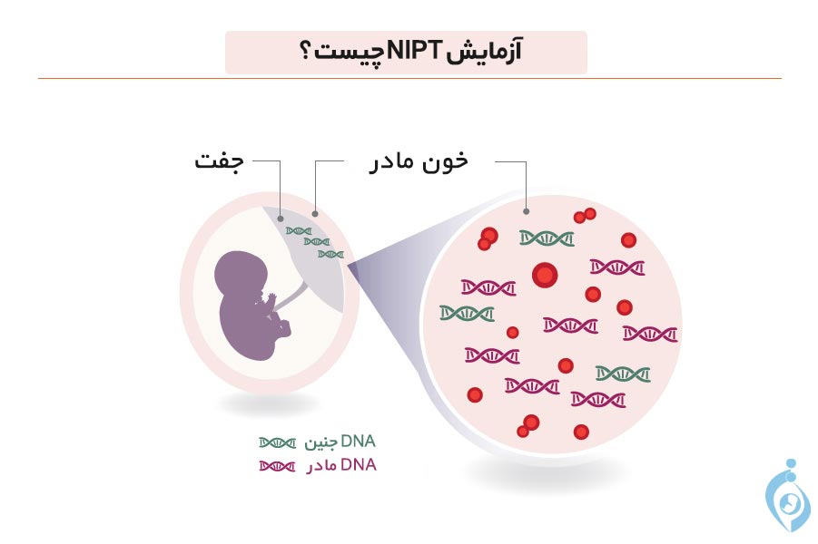 آزمایش NIPT