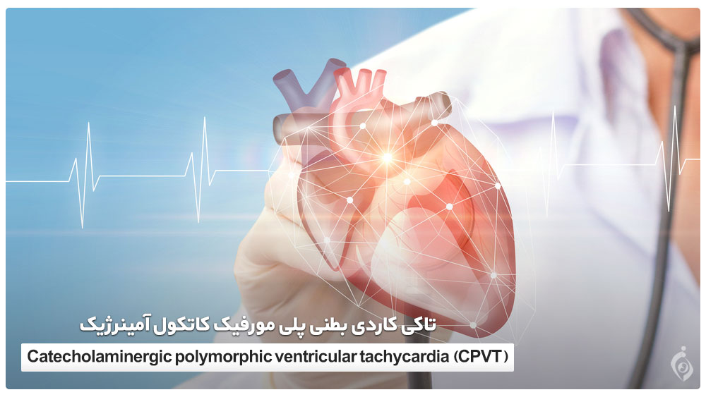 Catecholaminergic polymorphic ventricular tachycardia (CPVT)