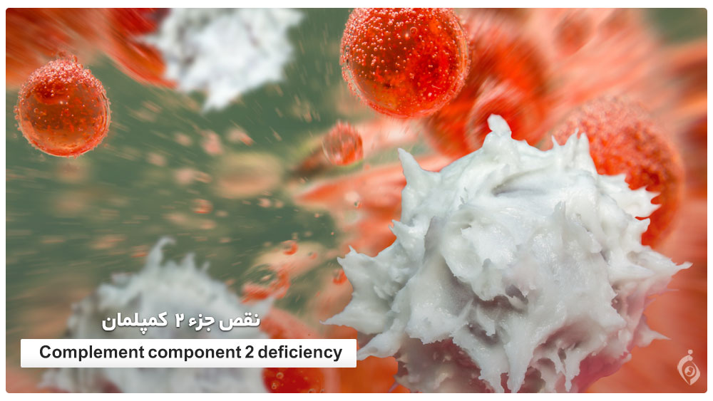 Complement component 2 deficiency