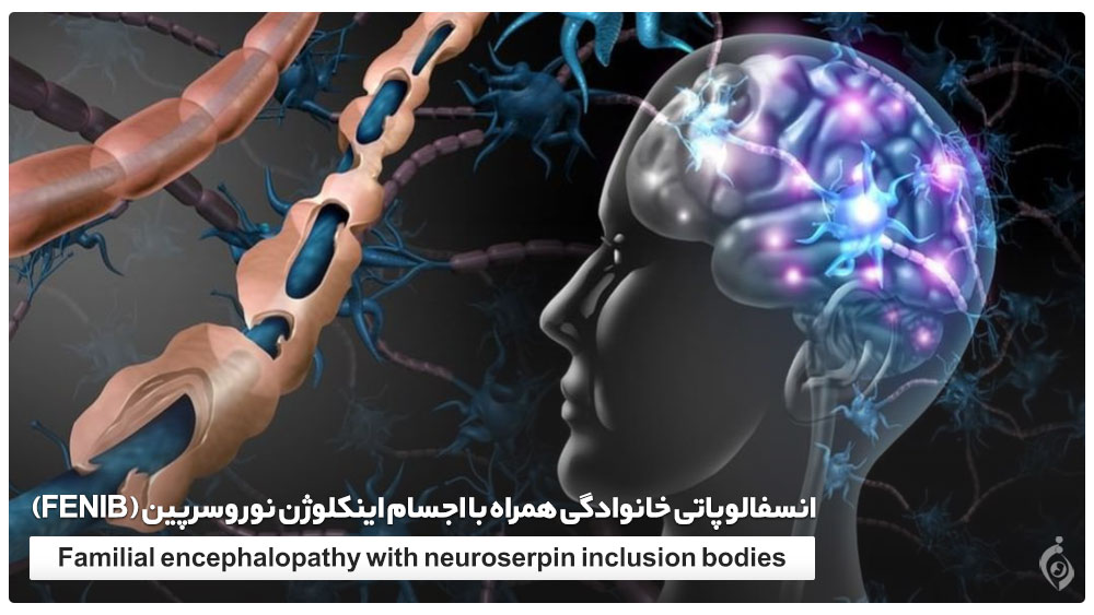 Familial encephalopathy with neuroserpin inclusion bodies