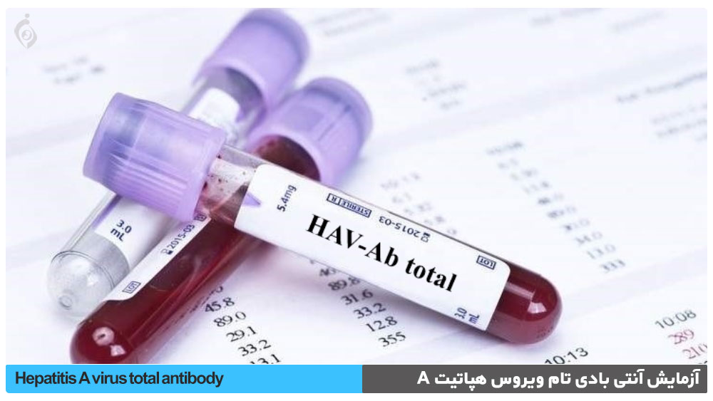 آزمایش آنتی بادی تام ویروس هپاتیت A