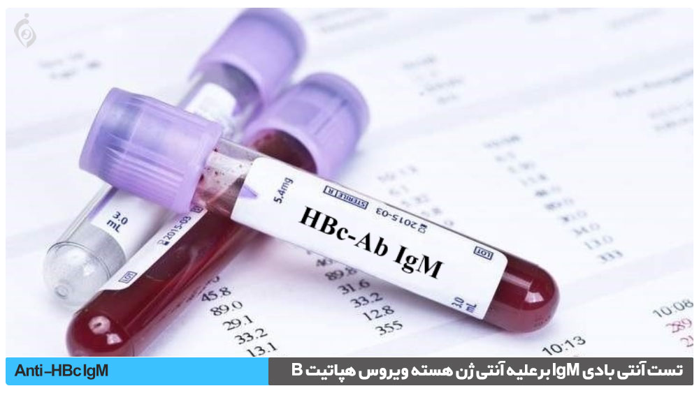 تست آنتی بادی IgM بر علیه آنتی ژن هسته ویروس هپاتیت B (آزمایش HBcAb IgM)