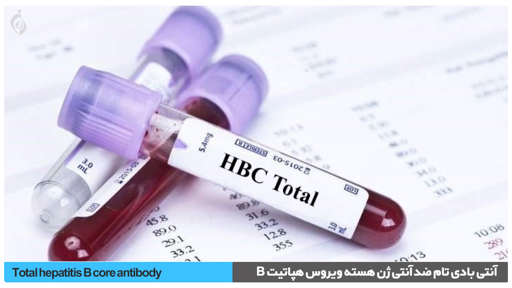 آزمایش (HBc Ab (Total , آنتی بادی تام ضد آنتی ژن هسته ویروس هپاتیت B