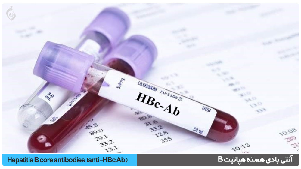 آزمایش anti-HBc , HBc Ab آنتی بادی هسته هپاتیت B