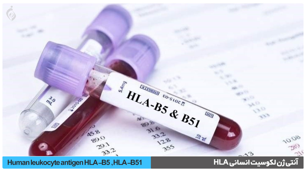 آنتی ژن لکوسیت انسانی HLA-B5 , HLA-B51
