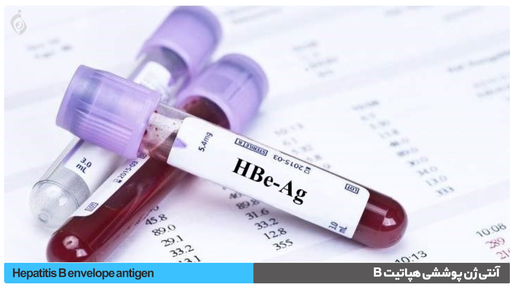 آنتی ژن پوششی هپاتیت B