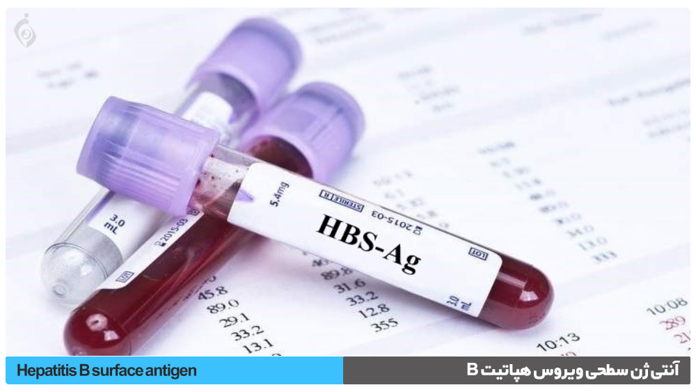 آنتی ژن سطحی هپاتیت ب (HBsAg)