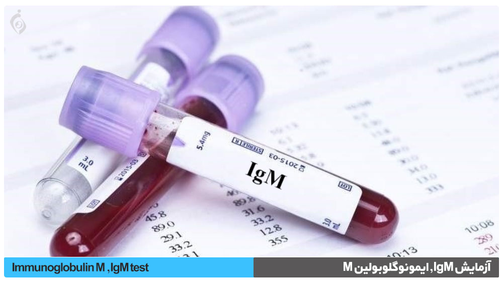 آزمایش IgM , ایمونوگلوبولین M