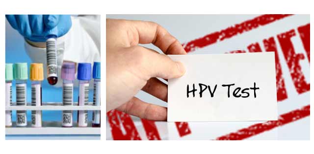 آزمایش hpv