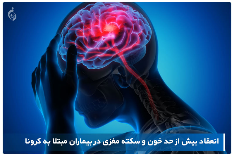 کرونا و سکته مغزی