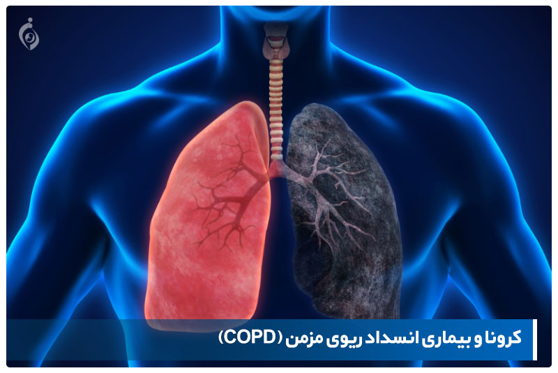 کرونا و ریه copd